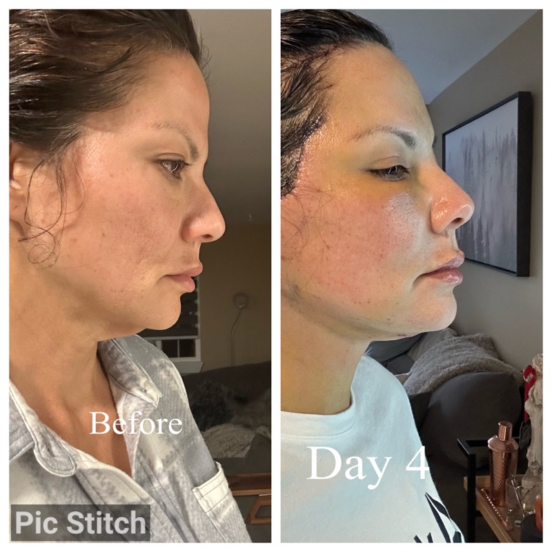 Selfie Testimonials  Bellevueand Bellevue