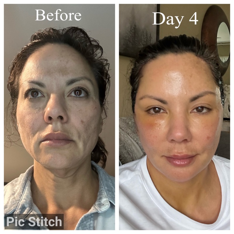 Selfie Testimonials  Bellevueand Bellevue