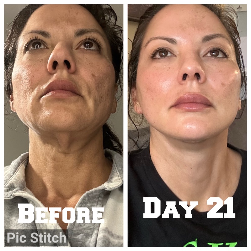 Selfie Testimonials  Bellevueand Bellevue