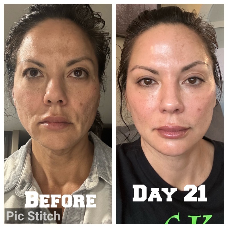Selfie Testimonials  Bellevueand Bellevue