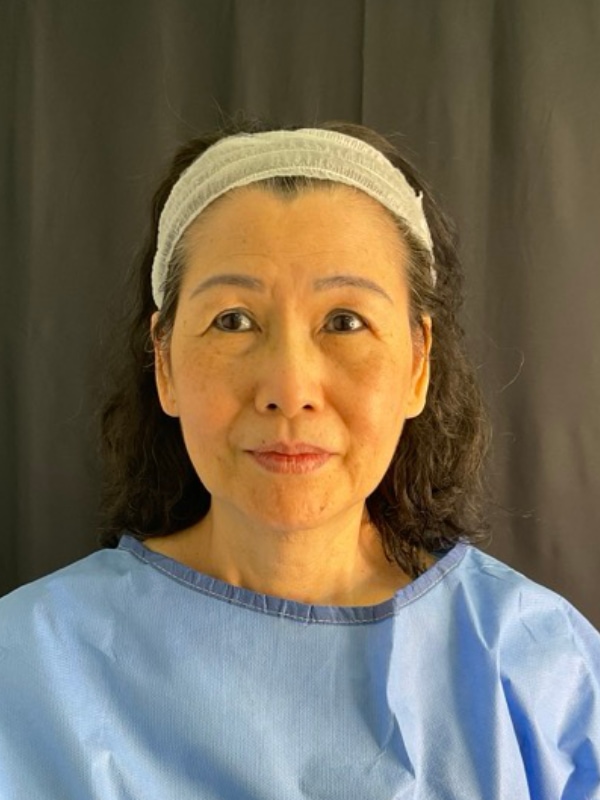 eyelid surgery Before & After Image