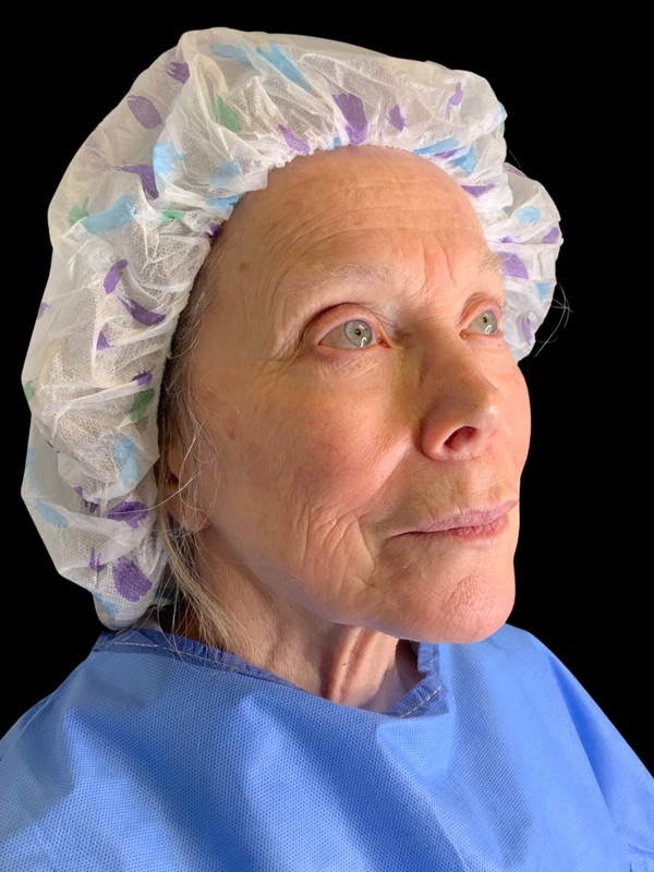 Preservation Facelift Before & After Image